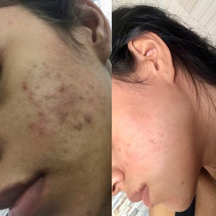 Ultra Whitening Cream