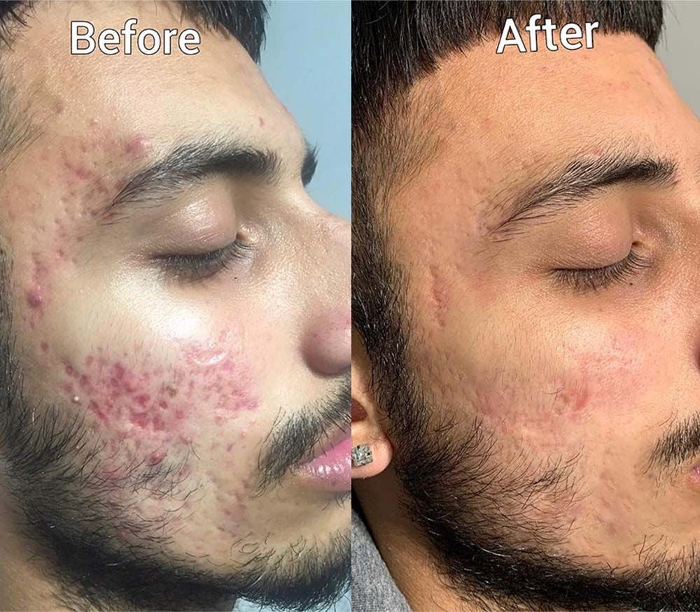 Decimal Advanced Skin Whitening Cream