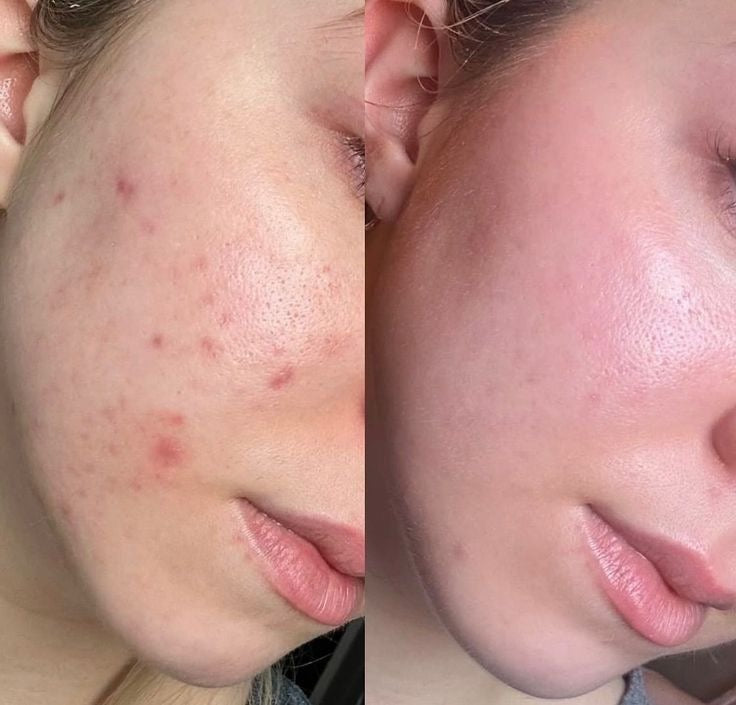 Decimal Advanced Skin Whitening Cream