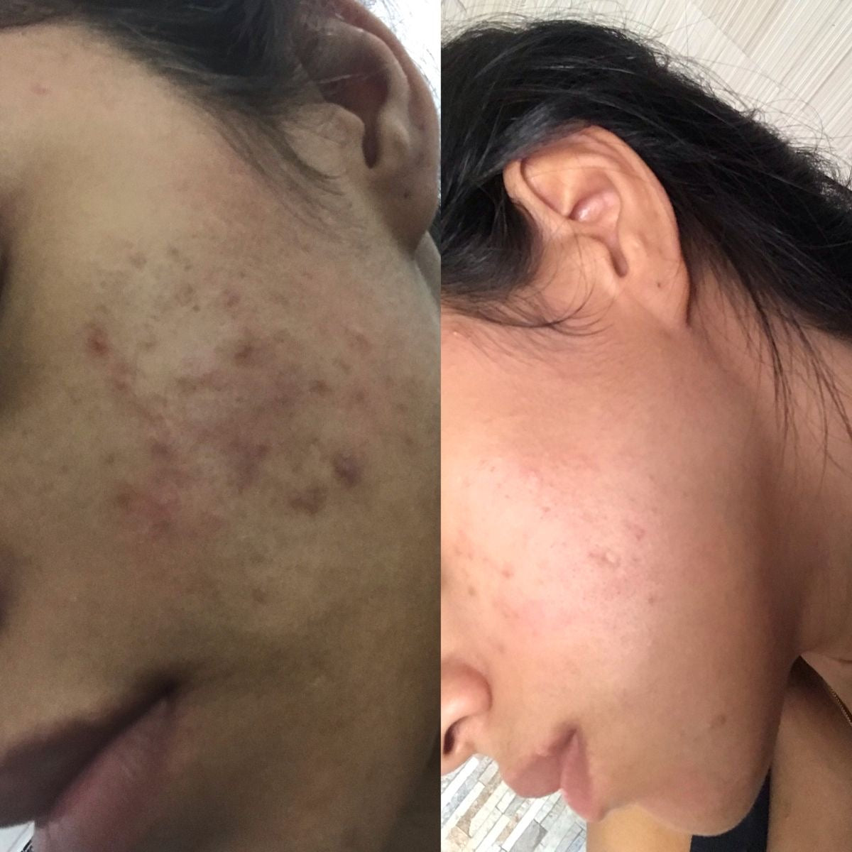 Decimal Skin Brightening Cream