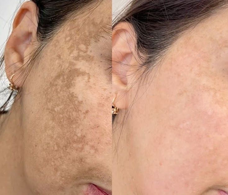Decimal Skin Brightening Cream