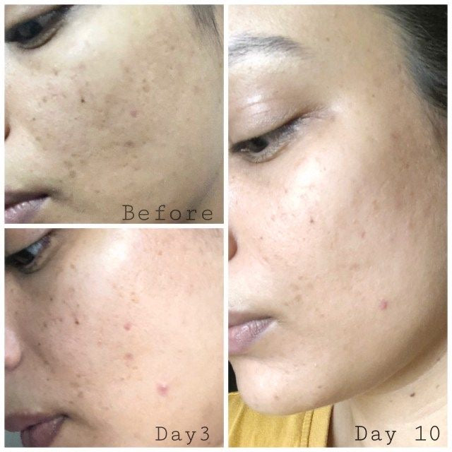Decimal Vitamin C Face Serum